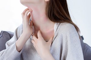 花粉症による皮膚症状 院長